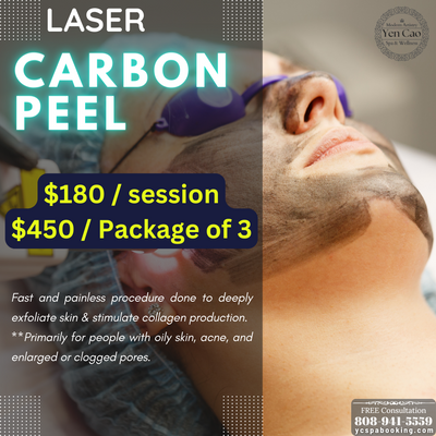 Laser Carbon Peel